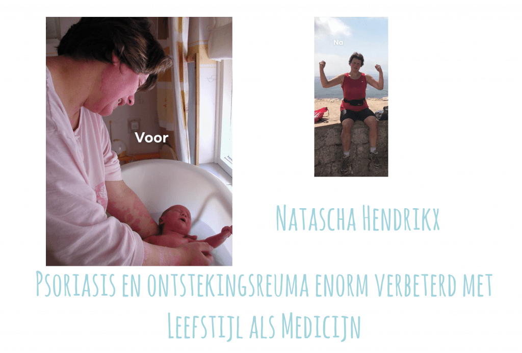 Natascha Hendrikx Psioriasis en Ontstekingsreuma